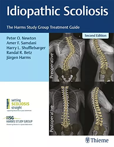 Idiopathic Scoliosis: The Harms Study Group Treatment Guide, 2nd Edition